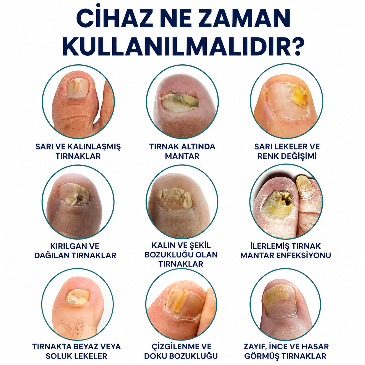 TEMİZ TIRNAKLAR İÇİN